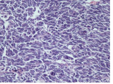 Fig 1B
